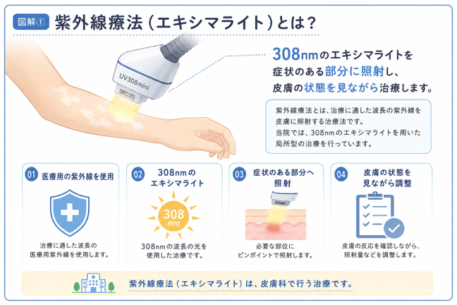 紫外線療法とは?