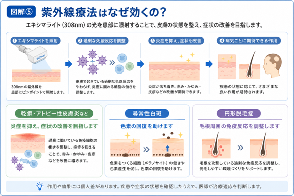 紫外線療法はどのように作用するの?